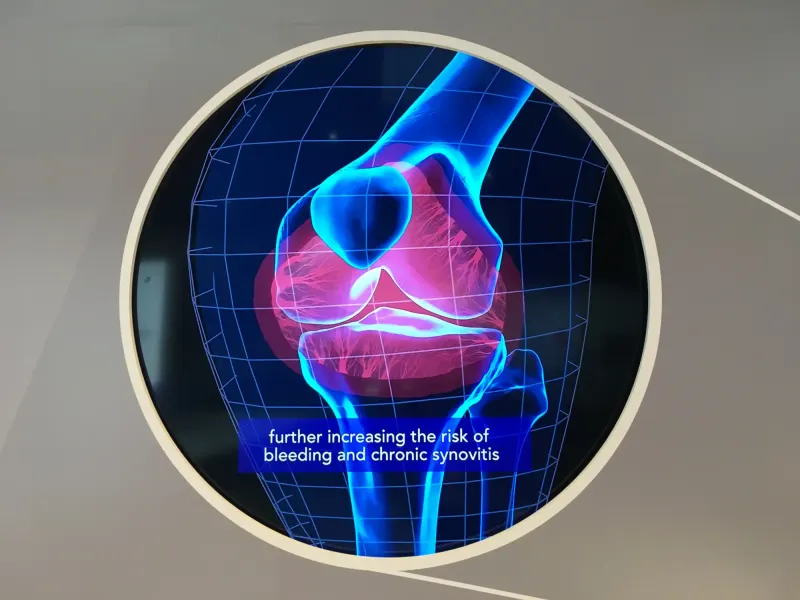 ISTH Congress exhibition stand designed and built by Ephology — photo 11